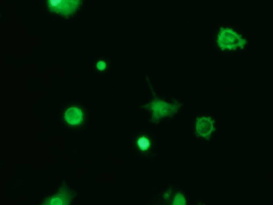 NEPA21 / Primary - Mouse Microglia cells - Transfection Efficiency 23 per cent